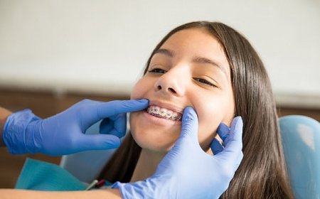 Ortodontik Tedaviler İçin ‘Ergenlik’ En İdeal Dönem