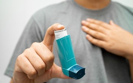 Ülkemizin Akciğerlerini Yok Eden Yangınlar Sağlığı da Etkiliyor!