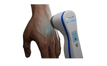 Üniversite öğrencisi babasının hastalığından yola çıkarak vitiligo tedavisi için cihaz geliştirdi